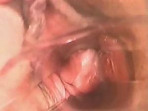 Insertion - Speculum Camera Inside Vagina!