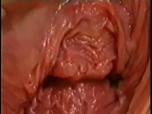 Monster Vagina. Extreme piercing. Fisting free